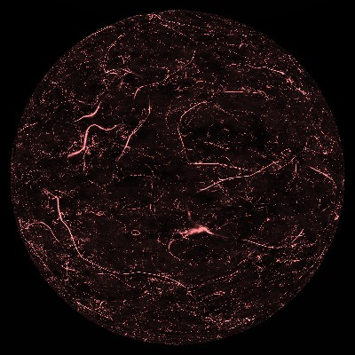 Veins and Floaters screenshot
